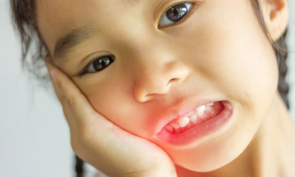 Broken and Chipped Teeth - Best Dentist Who Can Help 22 Broken or Chipped Teeth