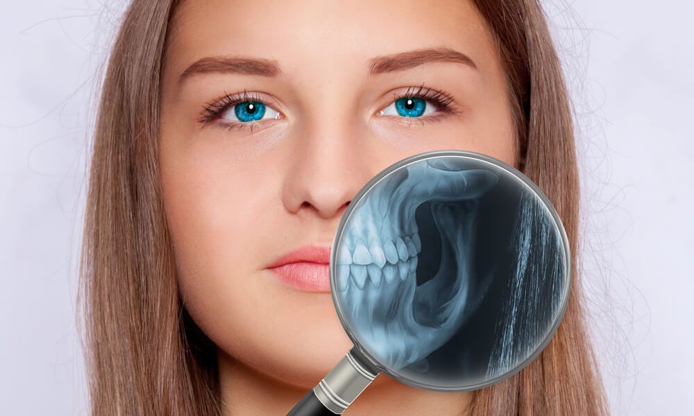 Choose A Dentist Who Offers Digital Dental Radiography 96 Digital Dental Radiography
