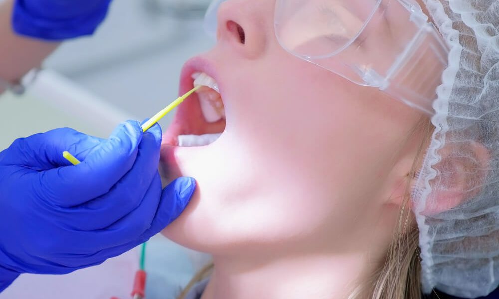 Choose A Dentist Who Offers Fluoride Treatments 87 Fluoride Treatments