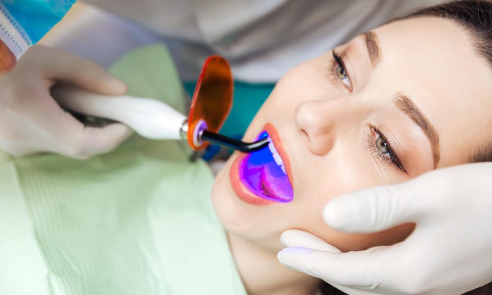 Choose A Dentist Who Offers Laser Caries Detection (or Cavity) 47 Laser Caries Detection